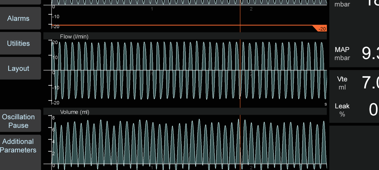 High Frequency Oscillation Ventilation Inspiration Healthcare